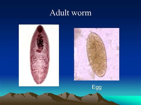  Heterophyes This Bizarre Trematode Worm Might Just Be Your Next Worst Nightmare