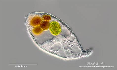 Rhodonema! A Ciliate That Defies Categorization With Its Remarkable Ability to Transform Itself and Feast on Smaller Organisms