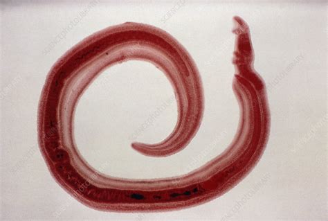  Schistosoma! A Parasitic Fluke That Lives Two Lives