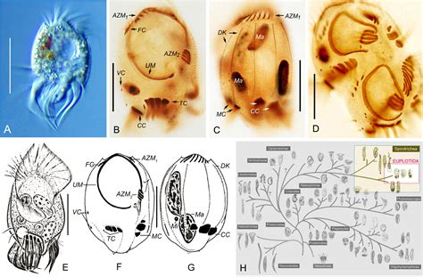  Uronychia: A Tiny Ciliate That's Always on the Move!